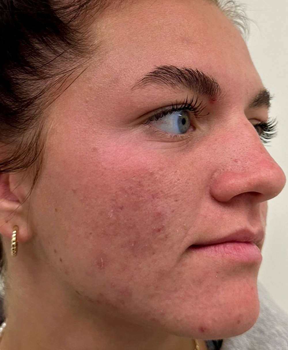 Turmeric Kojic Acid Pads 6 Screenshot 2024 06 22 at 10.07.29 PM