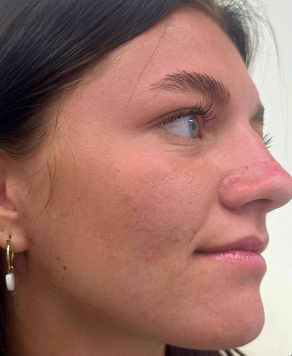 Turmeric Kojic Acid Pads 7 Screenshot 2024 06 22 at 10.07.35 PM