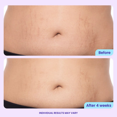 Skin Tightening & Smoothing Cream